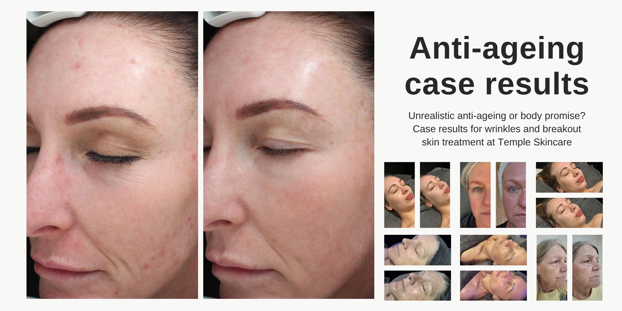 Anti-ageing case results