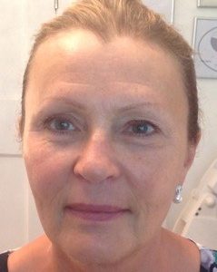 LED after skin rejuvenation 2