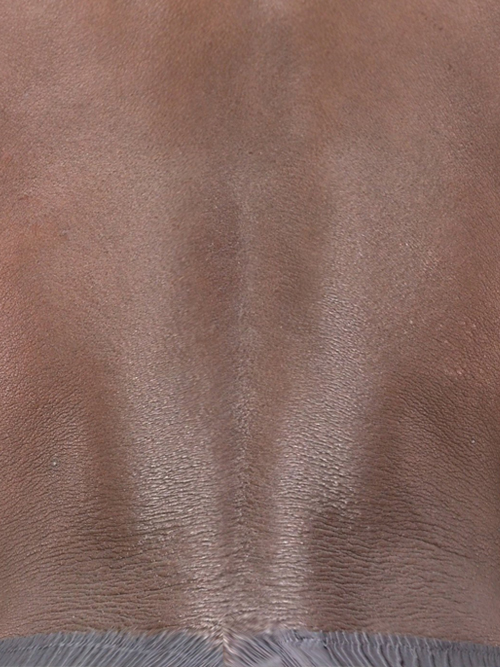 LED before pigmentation 2
