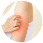 LED Light Therapy treats eczema