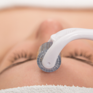 How to do Microneedling at home