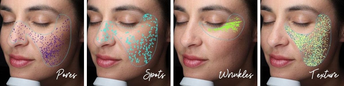visia skin analysis temple skincare & spa