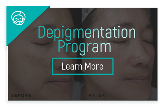 depigmentation FAQ
