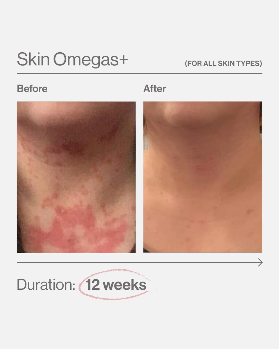 Advanced Nutrition Programme SKIN OMEGAS+ - Image 4