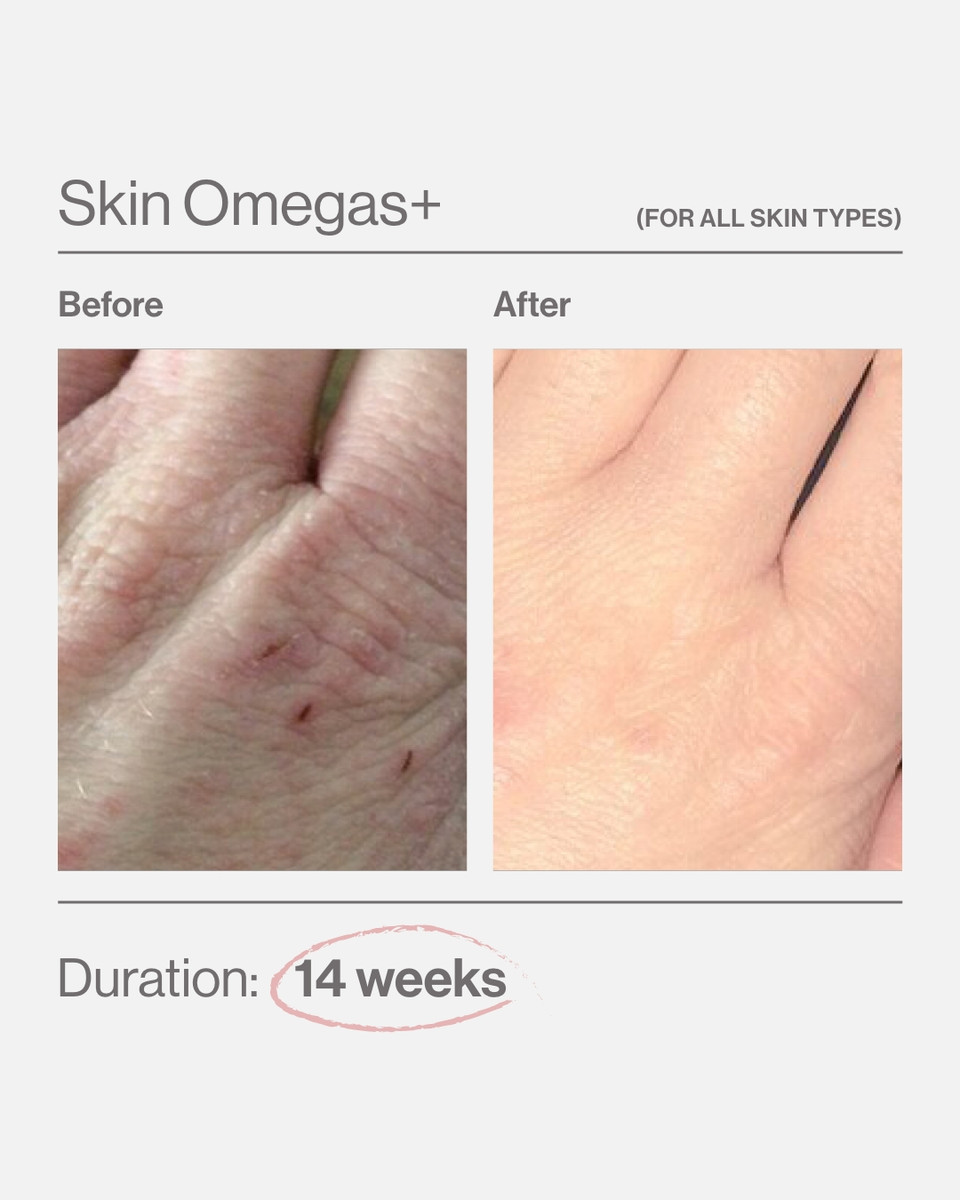 Advanced Nutrition Programme SKIN OMEGAS+ - Image 5