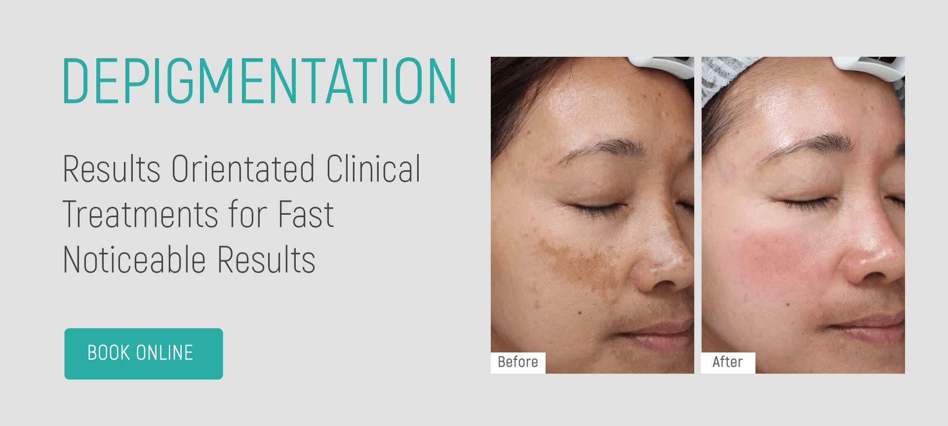 depigmentation temple skincare & spa