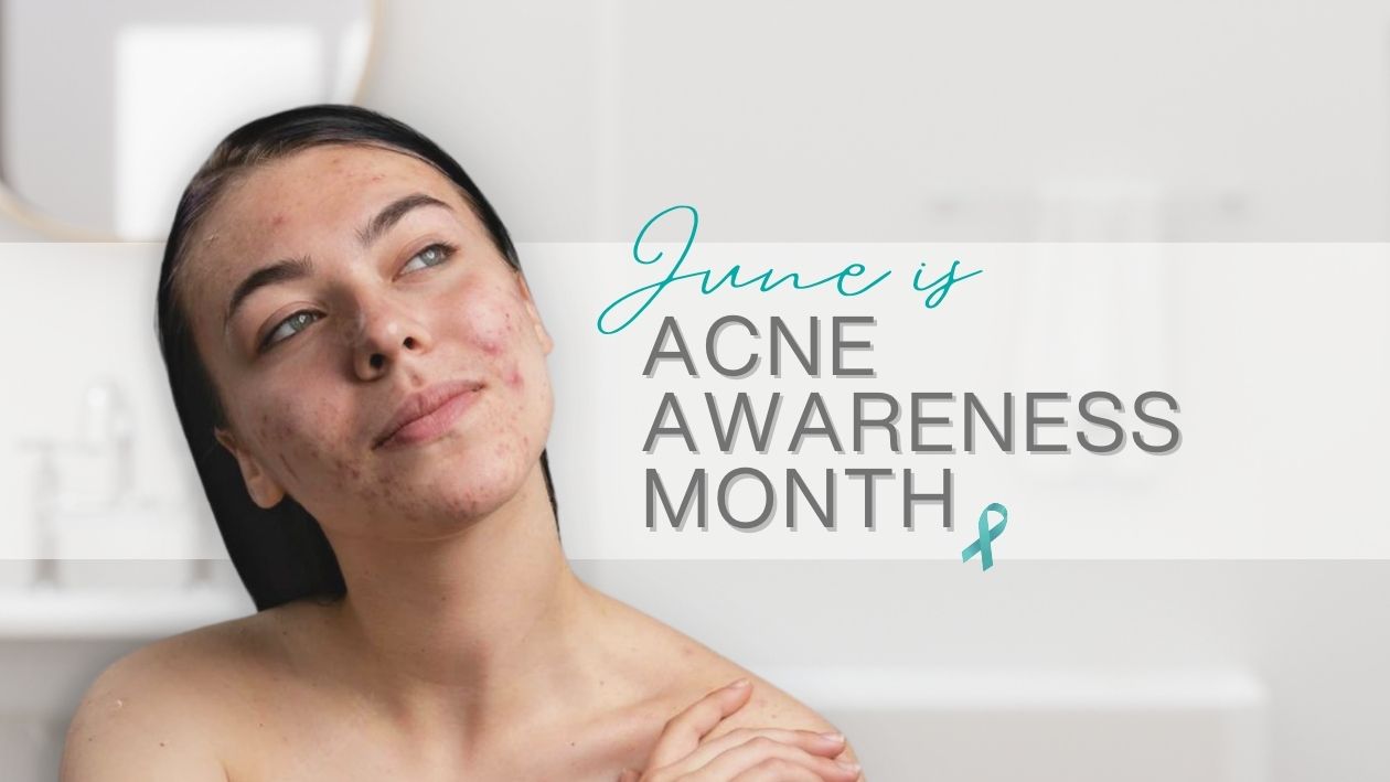 Embrace Your Skin, Embrace Yourself: Temple Skincare & Spa Celebrates Acne Awareness Month