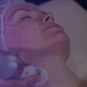 Embrace Timeless Beauty with HIFU Facials: Temple Skincare & Spa’s Ultimate Lift