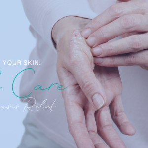 Nurturing Your Skin: Gentle Care for Psoriasis Relief