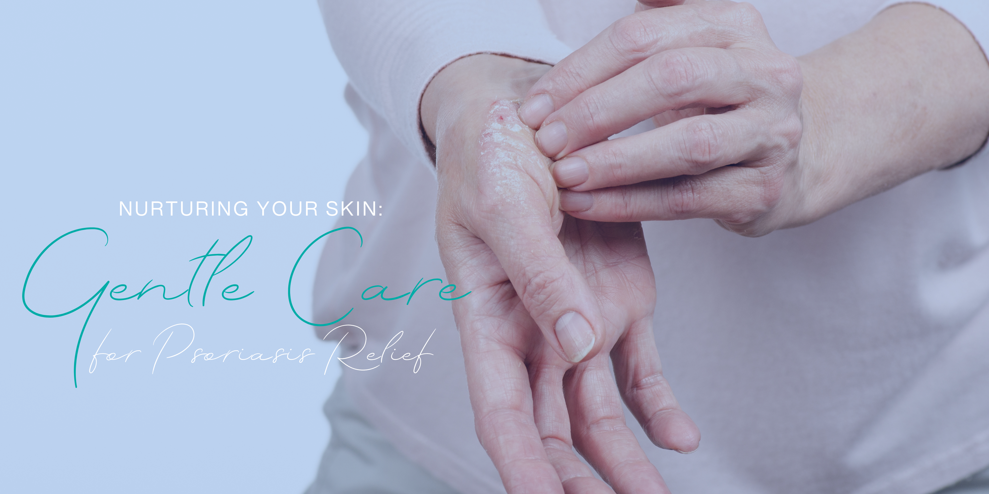 Nurturing Your Skin: Gentle Care for Psoriasis Relief