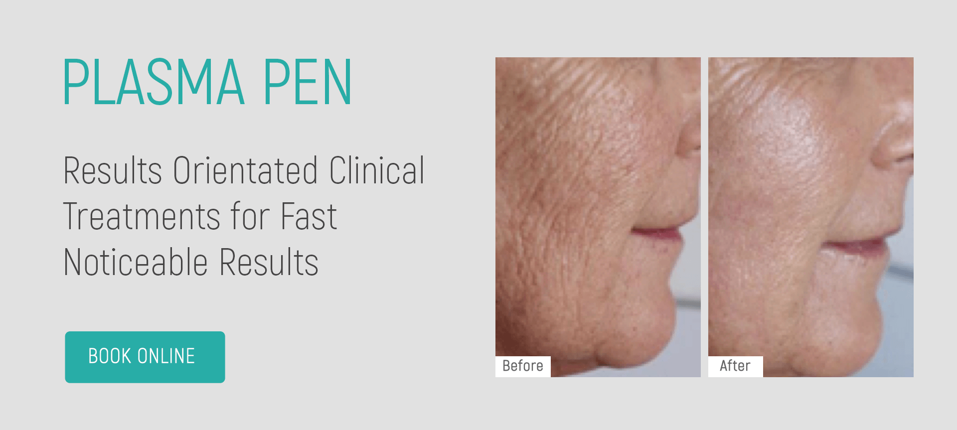 plasma-PEN-TEMPLE-SKINCARE-AND-SPA