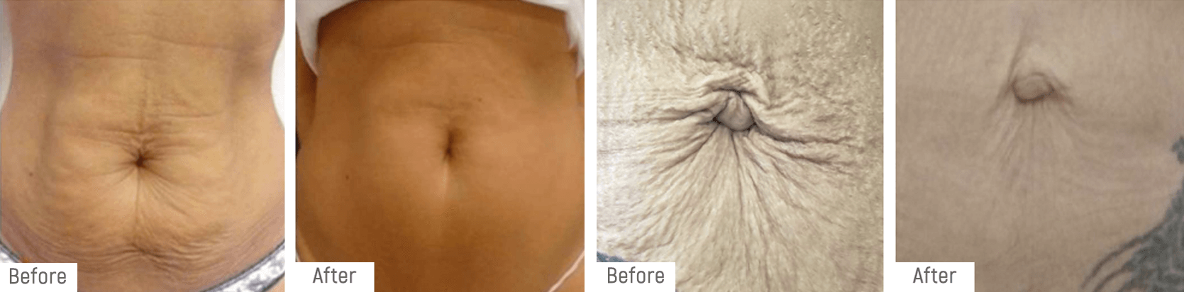 plasma-beforeafter1