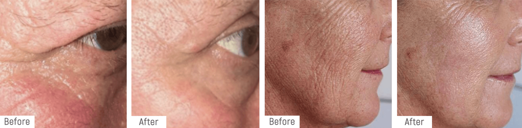 plasma-beforeafter2