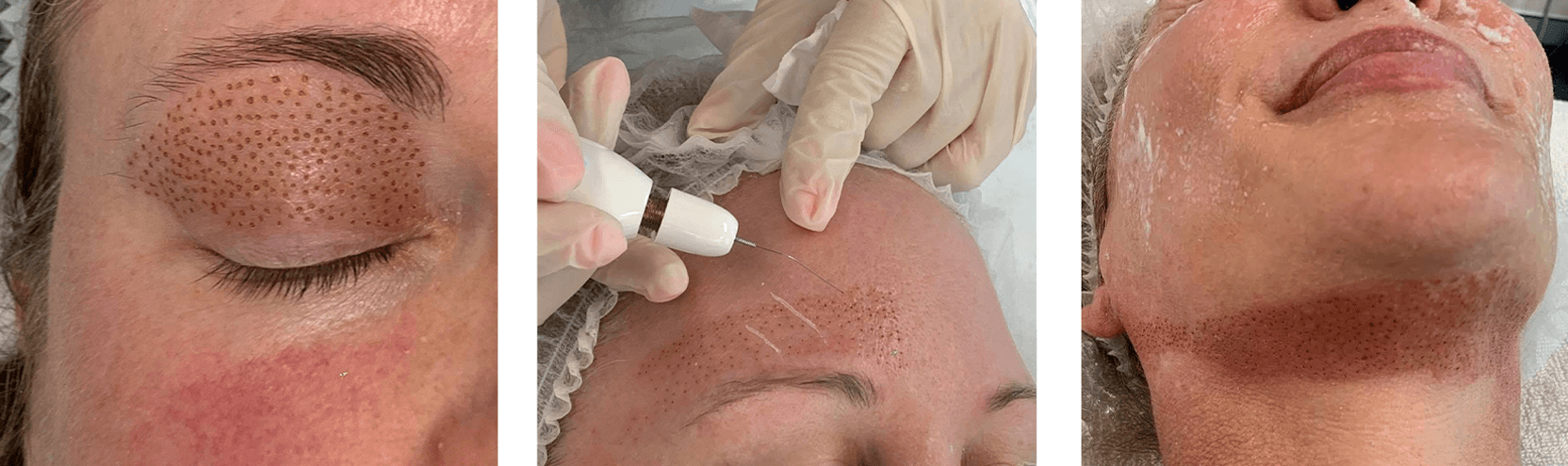 treatments
