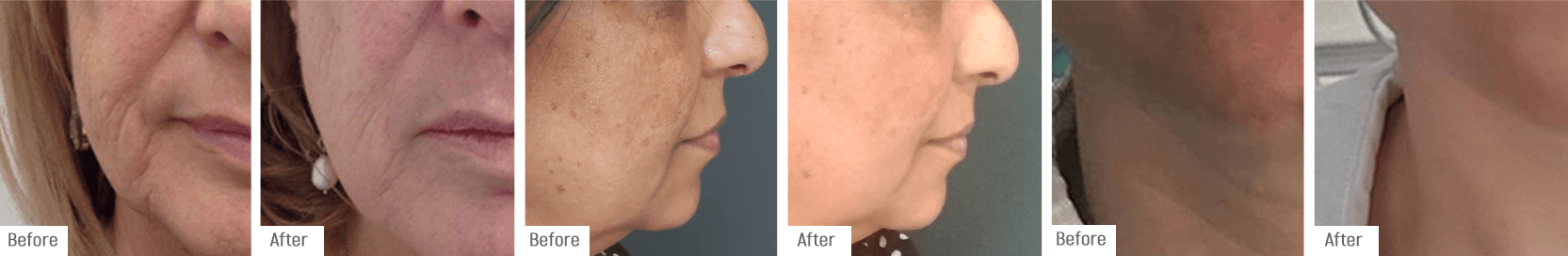 Temple clients in various stages of their treatment.