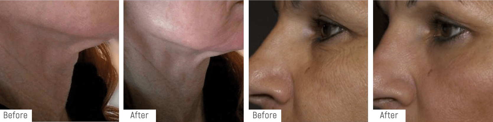 coaxmed-beforeafter