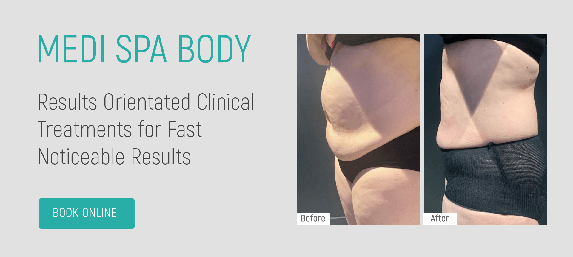 Medi-Spa Body
