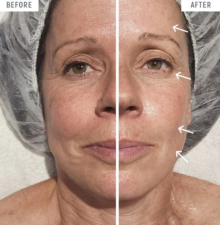 The Divine Pro Facial has immediate, lasting results to lift, plump and smooth ageing skin.