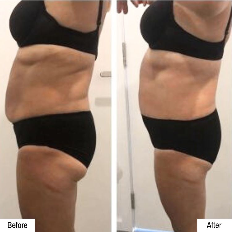 Lymphatic drainage temple skincare & spa castle hill