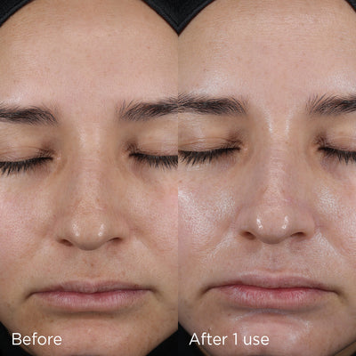 IMAGE - Prevention+ Pure Mineral Hydrating Moisturiser - Image 4