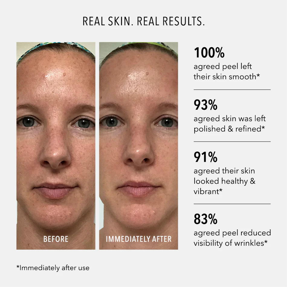 HydroPeptide Polish & Plump Face Peel - Image 4