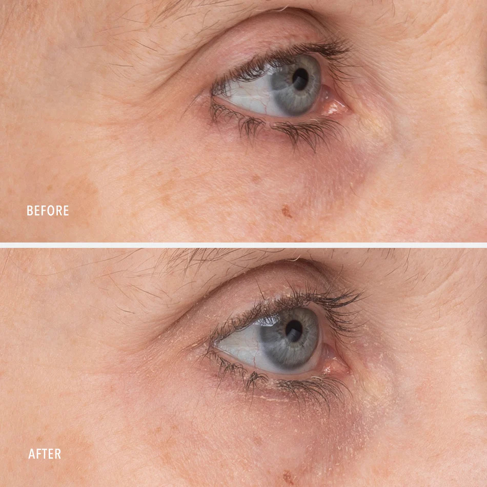 HydroPeptide Retinol Eye Renewal Balm - Image 5