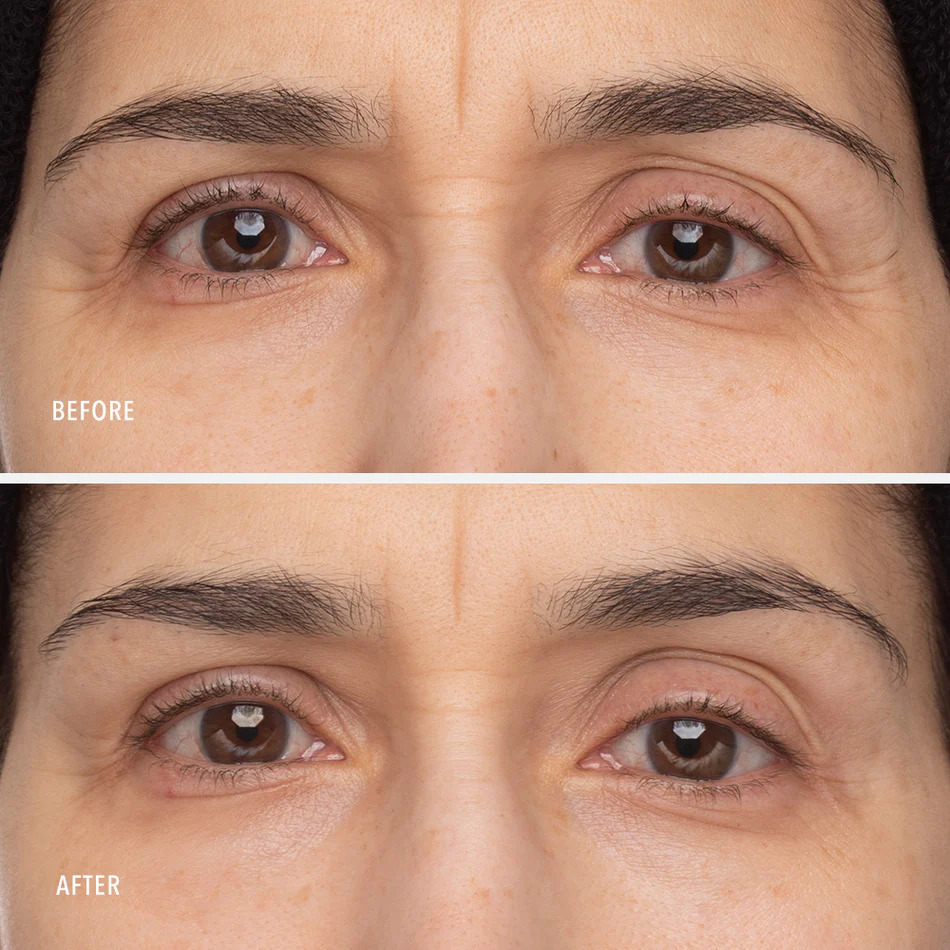 HydroPeptide Retinol Eye Renewal Balm - Image 4