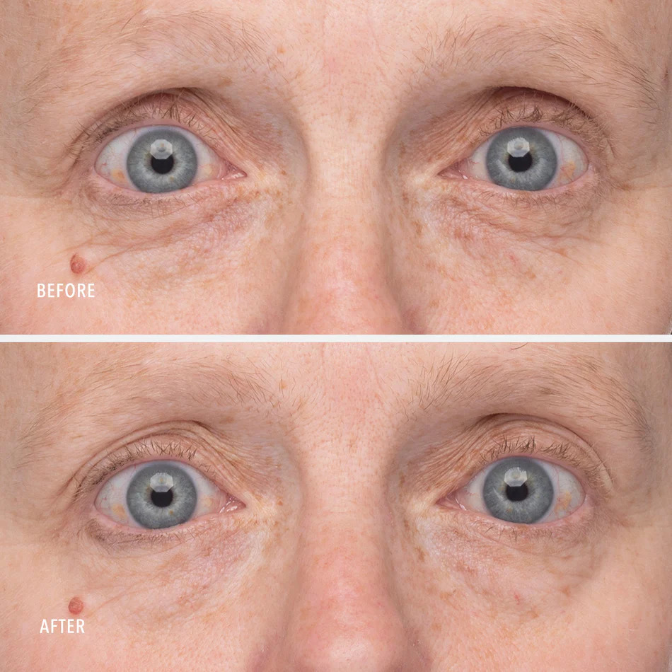 HydroPeptide Retinol Eye Renewal Balm - Image 8