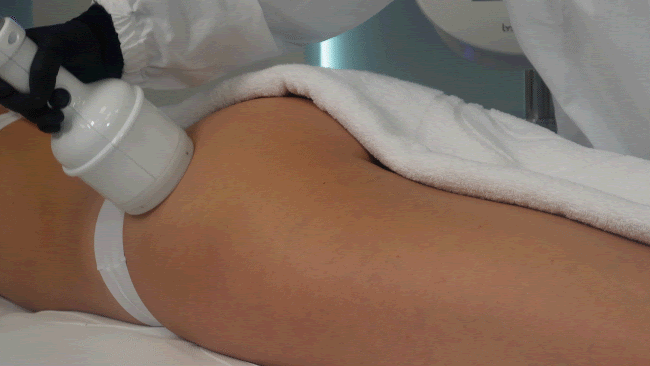 Temple Skincare & Spa is only one out of two other clinics authorised to perform Lysiwave treatments in the country.