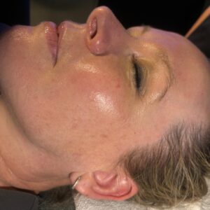 Rediscover Your Youth: Experience the Power of Skin Rejuvenation Treatments at Temple Skincare & Spa