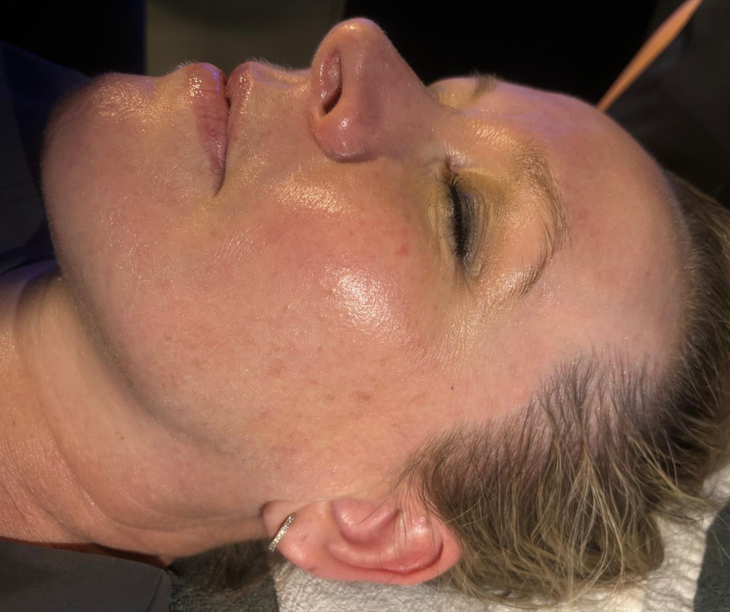 Rediscover Your Youth: Experience the Power of Skin Rejuvenation Treatments at Temple Skincare & Spa