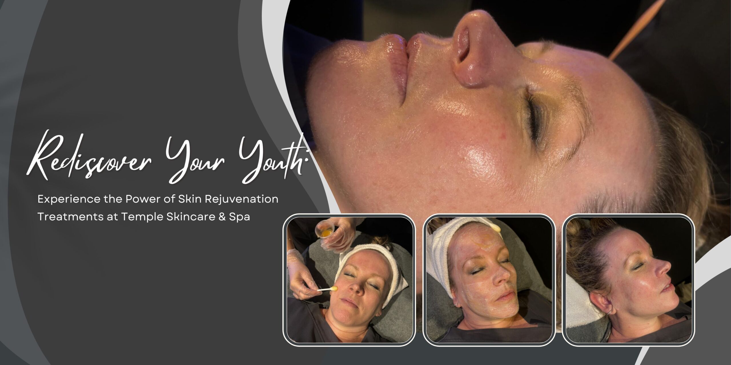 Rediscover Your Youth Experience the Power of Skin Rejuvenation Treatments at Temple Skincare & Spa