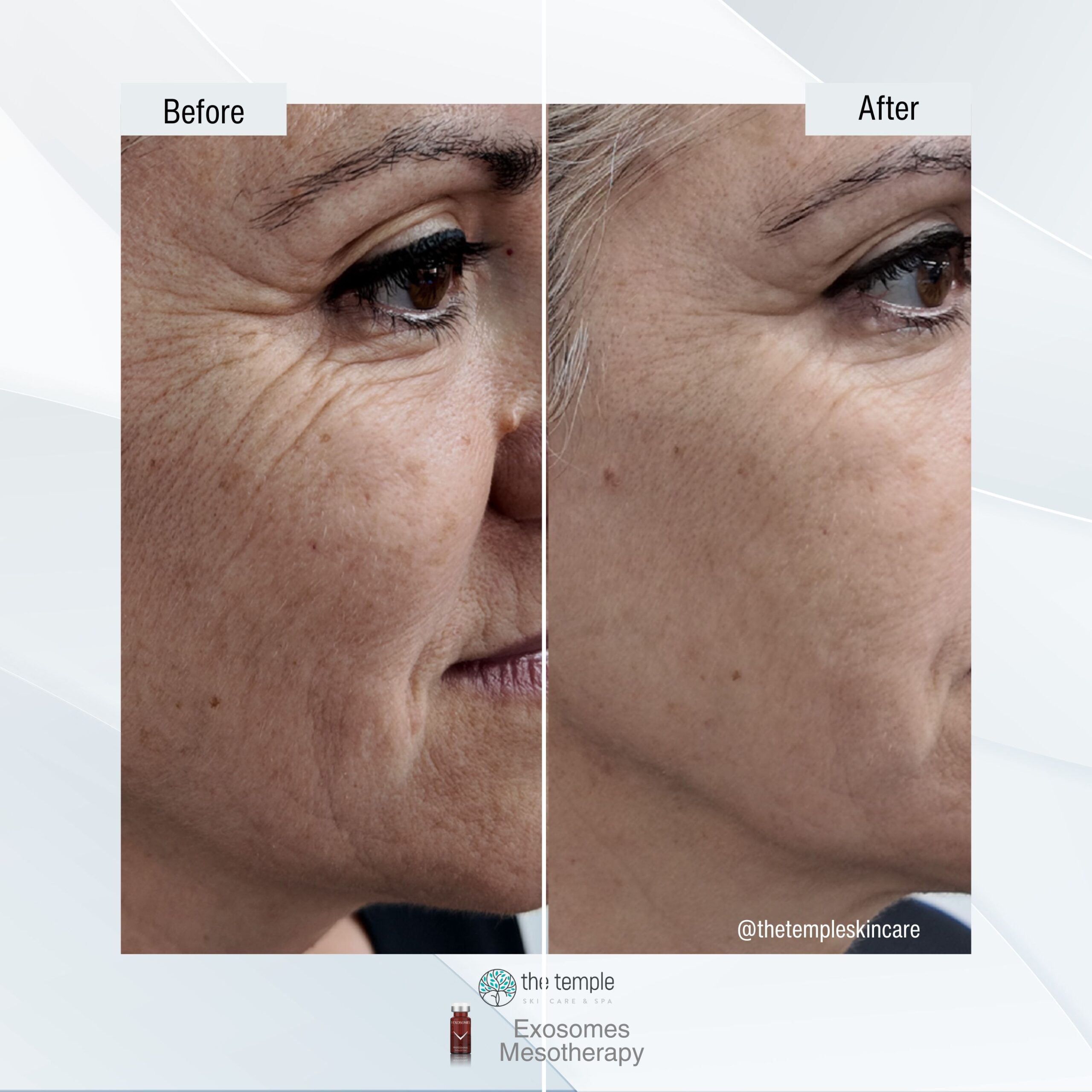 Exosomes before and after