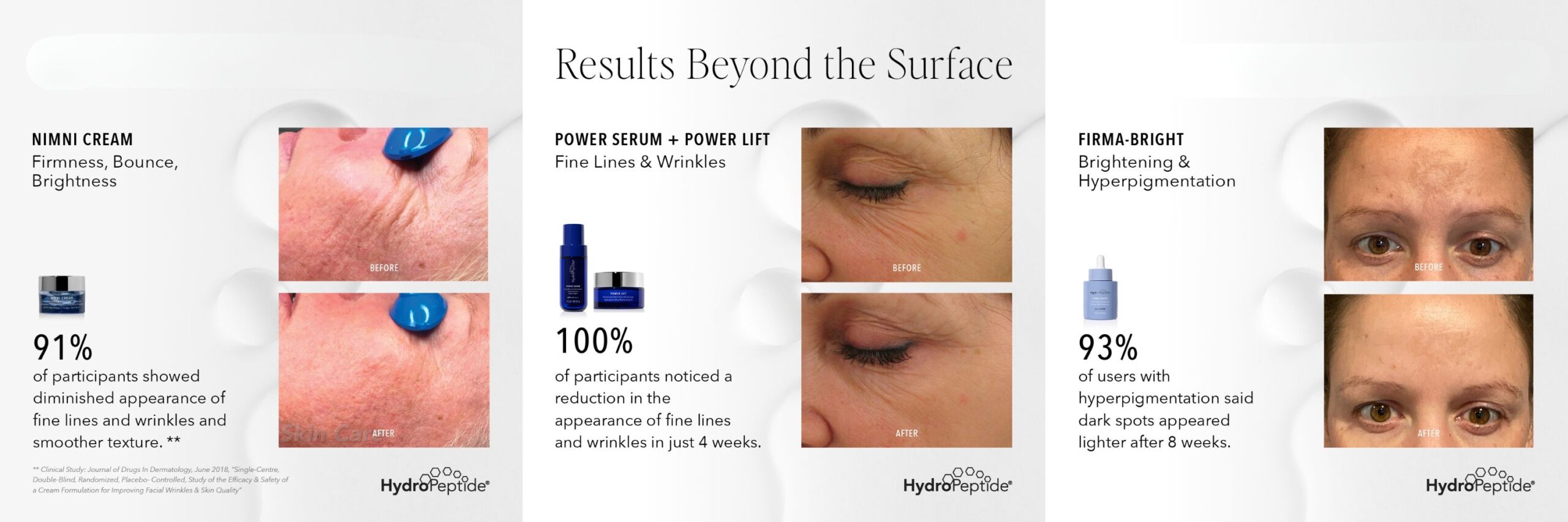 before ancd afters Hydropeptide