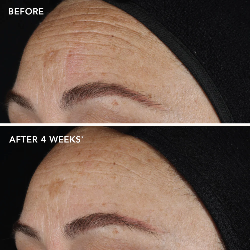Ageing Gracefully