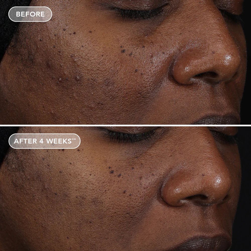 IMAGE AGELESS+ retinol repair crème 0.3% retinol complex - Image 6
