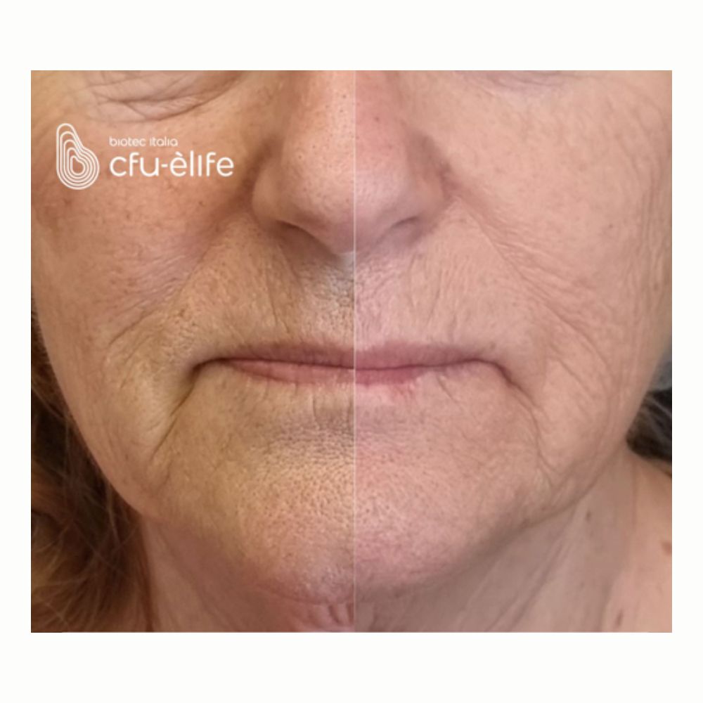 cfu eLife biotec italia (2)