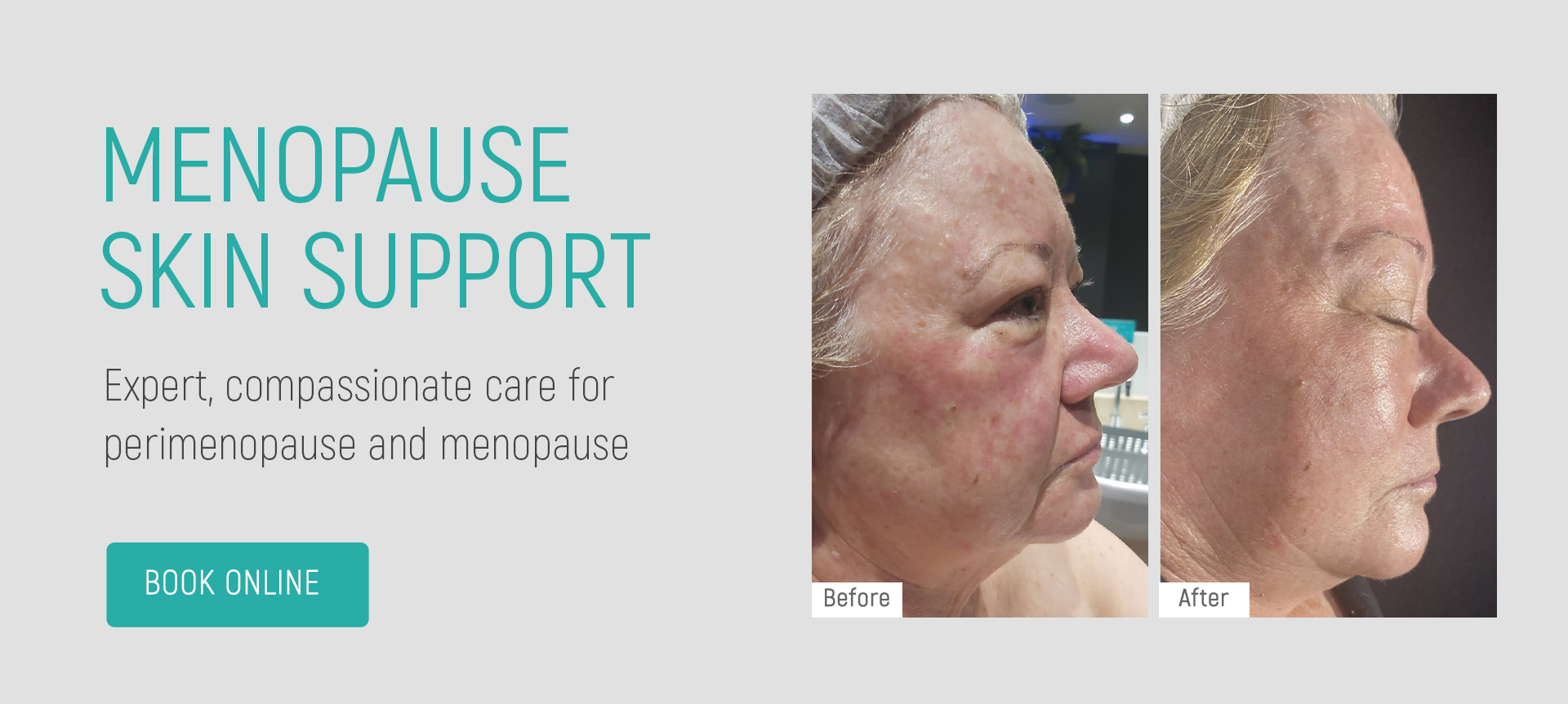 depigmentation-banner