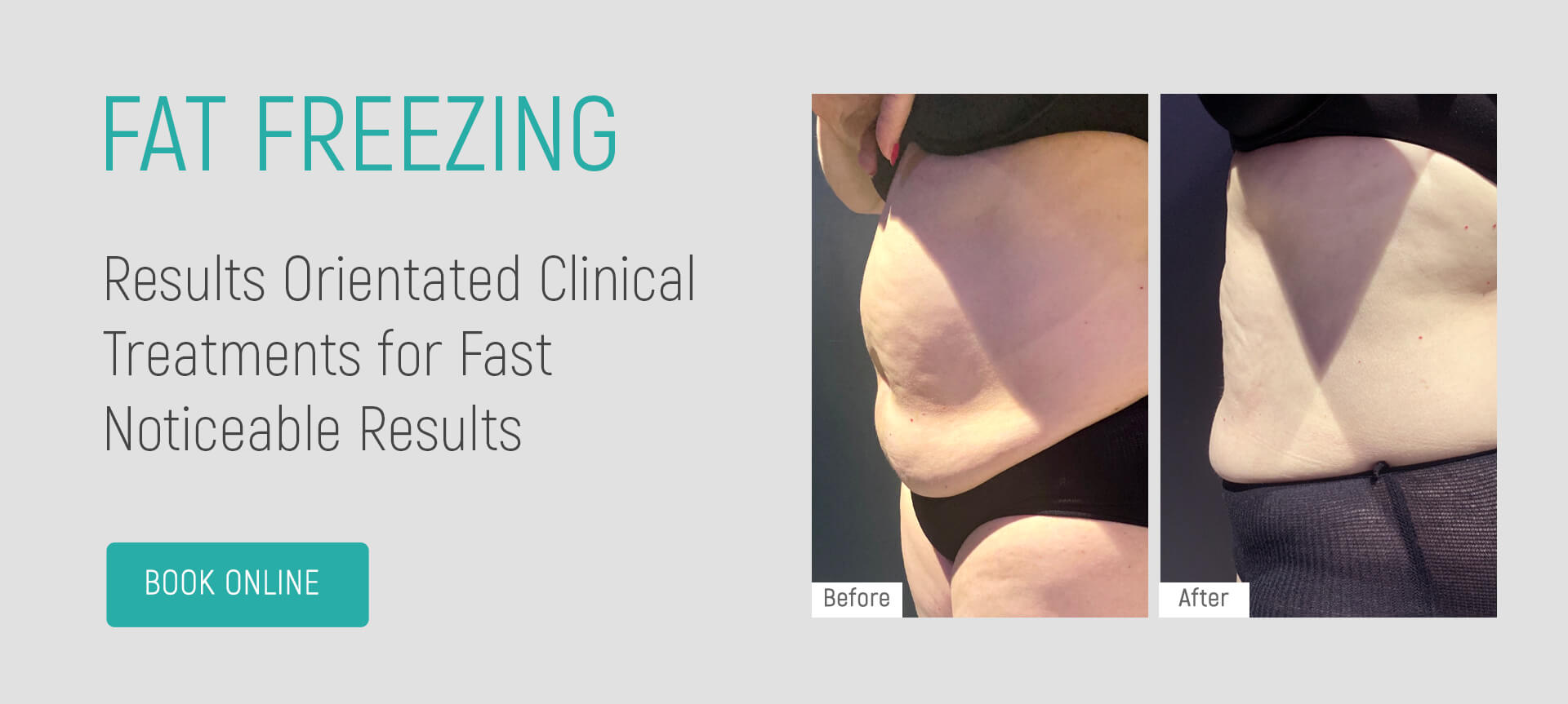 fat-freezing (2)