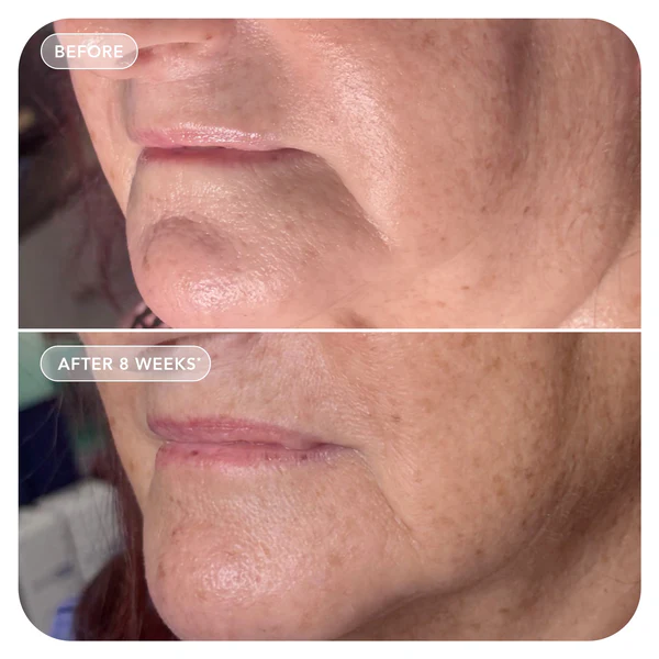 VOL.U.LIFT™ GLP-1 4D Skin Rebound Complex - Image 9