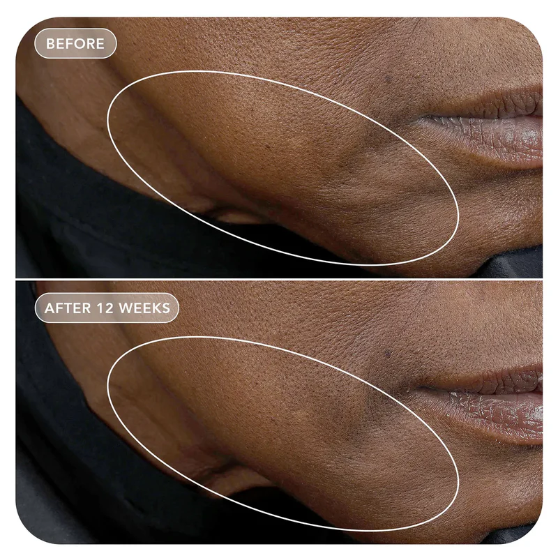 VOL.U.LIFT™ GLP-1 4D Skin Rebound Complex - Image 11