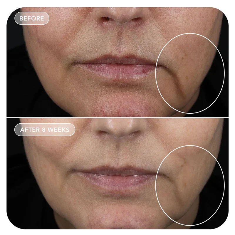 VOL.U.LIFT™ GLP-1 4D Skin Rebound Complex - Image 4