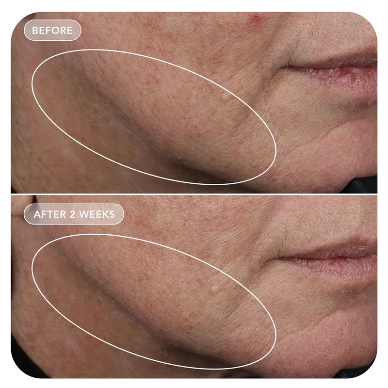 VOL.U.LIFT™ GLP-1 4D Skin Rebound Complex - Image 10