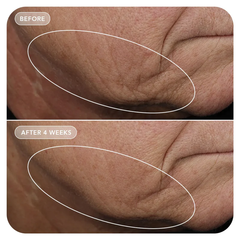 VOL.U.LIFT™ GLP-1 4D Skin Rebound Complex - Image 5