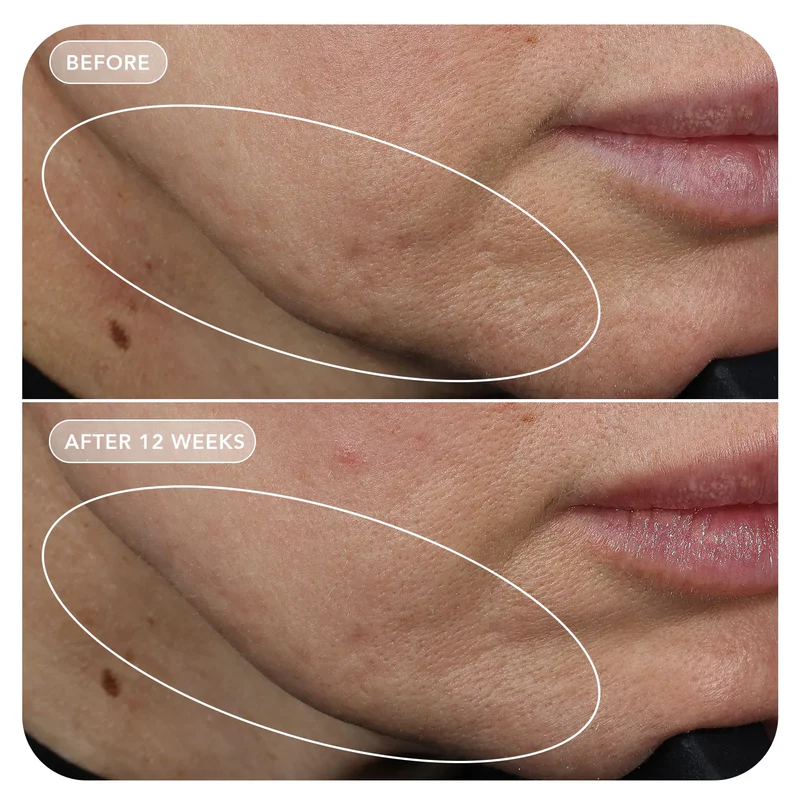 VOL.U.LIFT™ GLP-1 4D Skin Rebound Complex - Image 12
