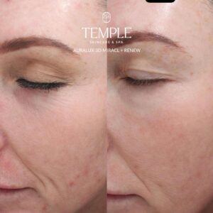 AURALUX™ Case Studies: Real Skin Concerns. Real Results. Real Confidence.