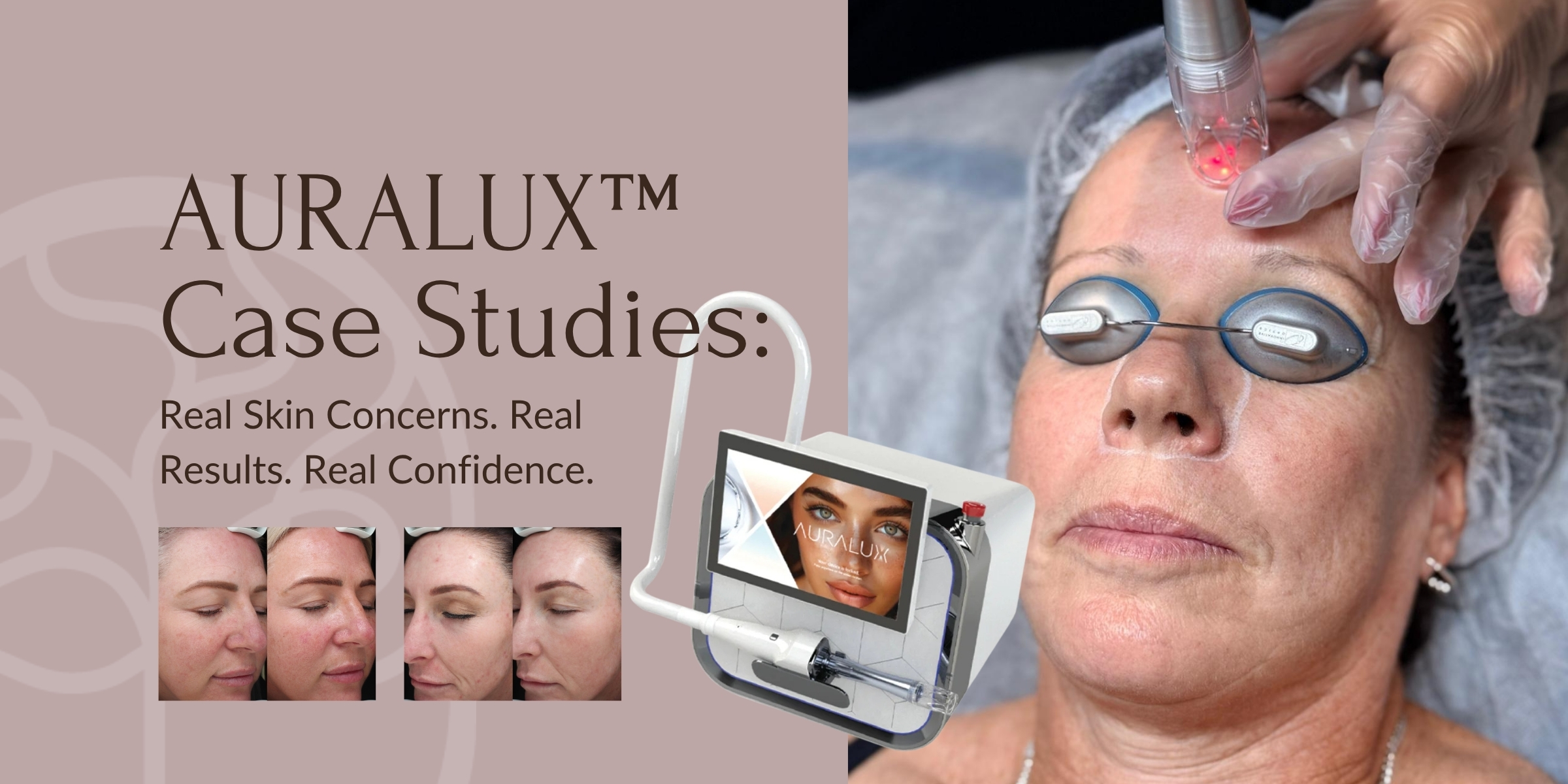 AURALUX™ Case Studies Real Skin Concerns. Real Results. Real Confidence. (2)