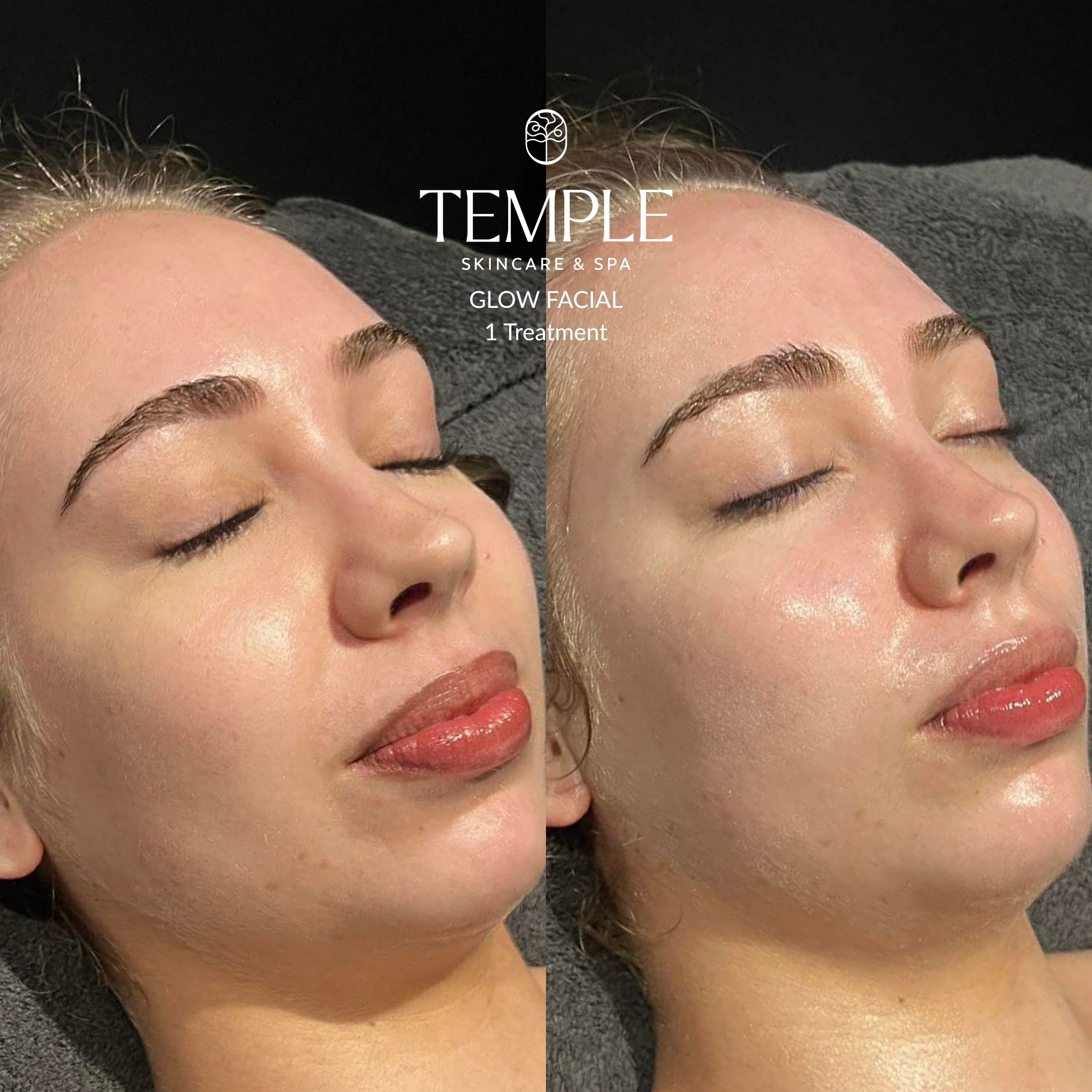 Facial Rituals