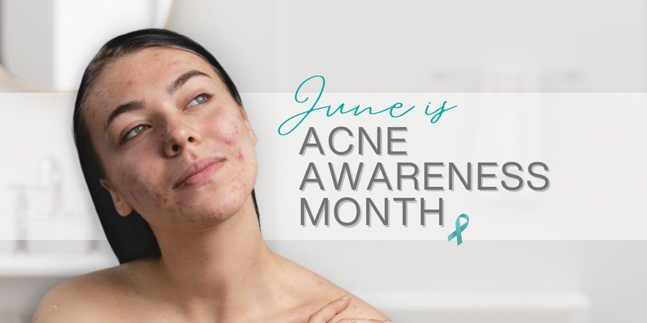 Temple Skincare & Spa ACNE AWARENESS MONTH (480 × 270 px) (2)