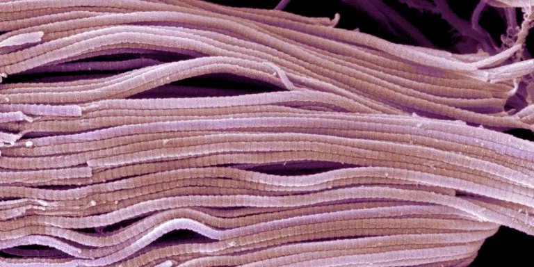 collagen-scanning-electron-micrograph-sem-91560124-583afd593df78c6f6aa75e6e